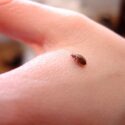 美国治理床虱臭虫 Bed Bug 的 5 种方法