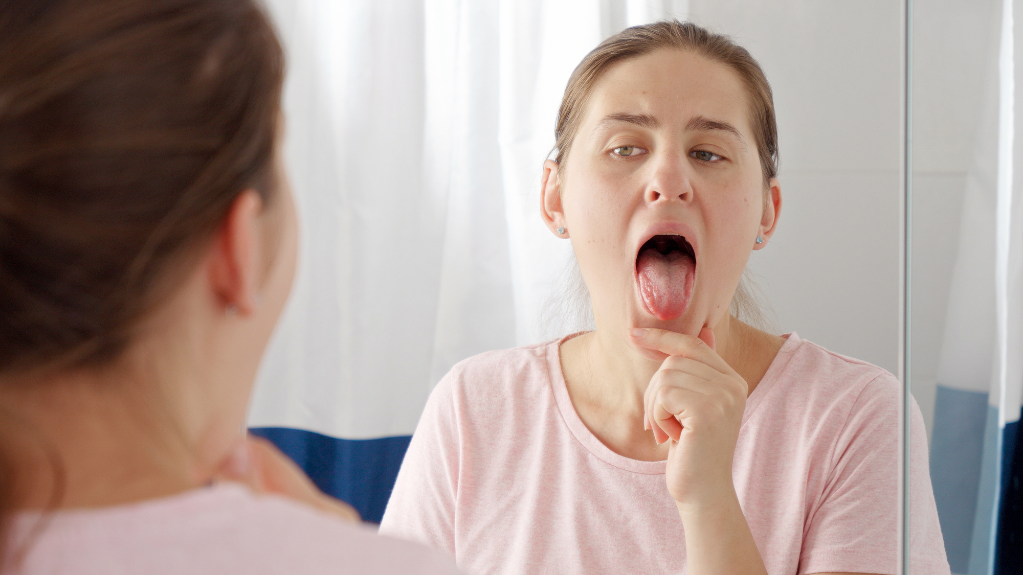 舌头发白的病因和家庭护理与用药