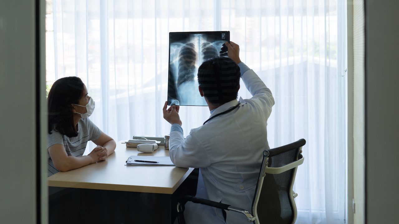 《我妻之死》刷屏：不吸烟的华人女性的肺癌风险